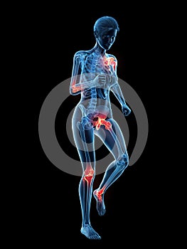 Painful joints while walking