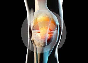 Painful knee joint anatomy. 3D illustration concept photo