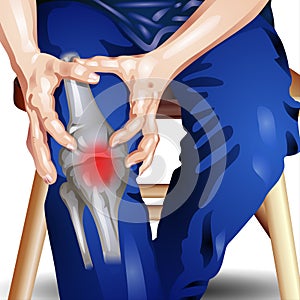 Painful knee joint pain and leg injury as chronic burning pain inflammation - Vector Illustration
