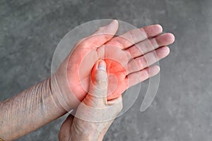 Painful palm of Asian woman. Concept of compartment syndrome, cellulitis and hand muscles pain photo