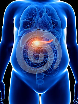 a painful pancreas