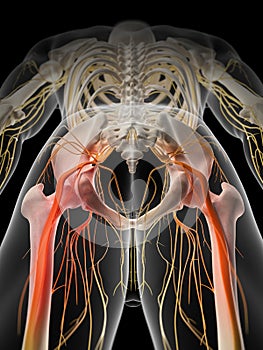 Painful sciatic nerve