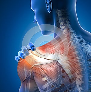 Painful shoulder joints. Frozen shoulder, Impingement. 3D illustration photo