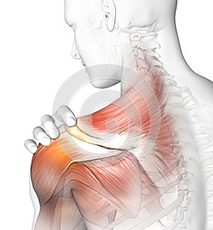 Painful shoulder joints. Frozen shoulder, Impingement. 3D illustration