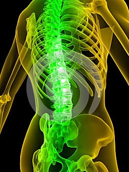 Painful spine photo