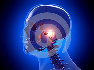 A painful temporomandibular joint