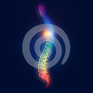 Painful thoracic spine, medically 3D illustration