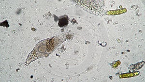 A pair of scavenger infusoria eat the corpse of a dead rotifer along with a colony of bacteria