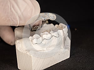 Palatal expander for the maxilla, setting test