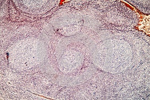 Palatal tonsils transverse