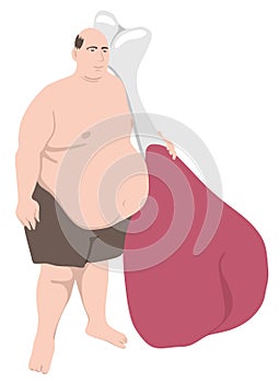 Paleo diet and obese man