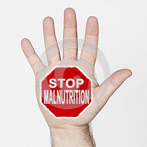 On the palm of the hand there is a stop sign with the inscription - STOP MALNUTRITION