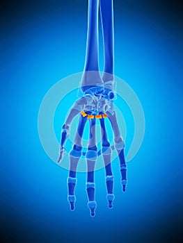 The palmar metacarpal ligament photo