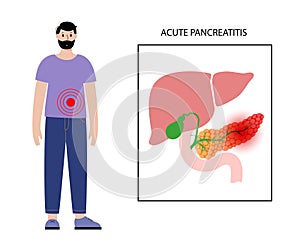 Pancreas disease and cancer