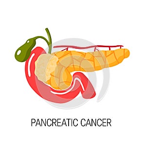 Páncreas cáncer. ilustraciones 