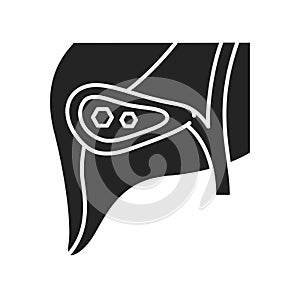 Pancreatic stones black glyph icon. Acute pancreatitis. Human organ concept. Sign for web page, mobile app, button, logo. Vector