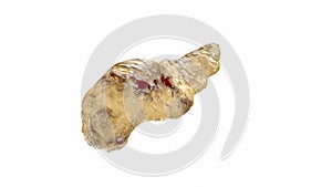 Pancreatitis disease of human pancreas isolated on white. 3d illustration