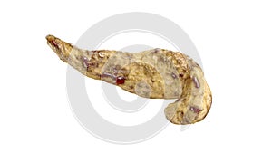 Pancreatitis disease of human pancreas isolated on white. 3d illustration