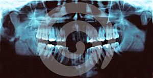 Panoramic dental radiology slide