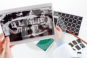 Panoramic dental X-Ray in hand.