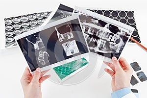 Panoramic dental X-Ray in hand.