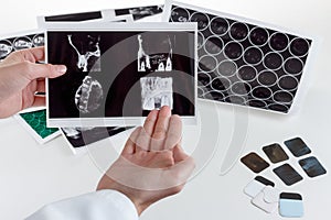 Panoramic dental X-Ray in hand.