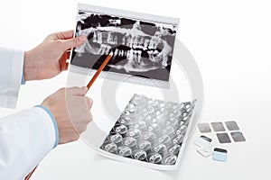 Panoramic dental X-Ray in hand.