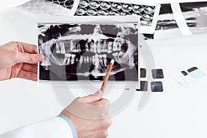 Panoramic dental X-Ray in hand.