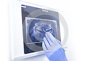 Panoramic dental xray photo
