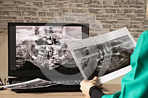 Panoramic X-ray of children`s teeth of two jaws, orthopantomogram of children`s teeth on laptop screens at the doctor`s table