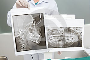 Panoramic x-ray jaw. A dentist holding an x-ray the patient`s to