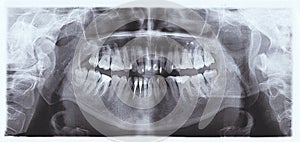 Panoramic tooth shot. dental X-Ray image of teeth