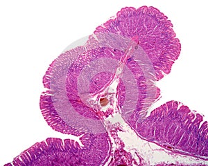 Gastric mucosa photo