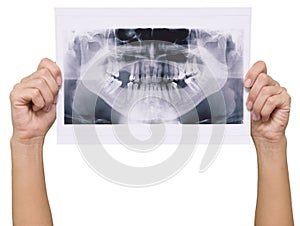 Panoramic x-ray skan
