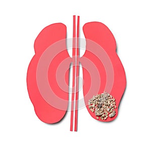 Paper cutout with stones on white background, top view. Kidney stone disease