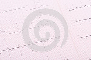 Paper with heartbeat readings, close-up background