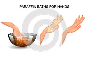 Paraffin baths for hands