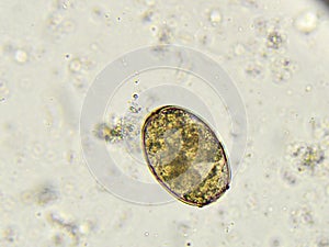 Paragonimus westermani (lung fluke)