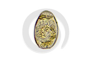 Paragonimus westermani (lung fluke)