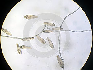 Paramecium