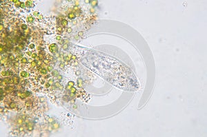 Paramecium caudatum is a genus of unicellular ciliated protozoan