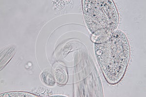 Paramecium caudatum is a genus of unicellular ciliated protozoan and Bacterium.