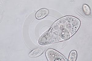 Paramecium caudatum is a genus of unicellular ciliated protozoan under the microscope.