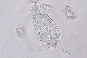 Paramecium caudatum is a genus of unicellular ciliated protozoan under the microscope.