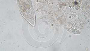 Paramecium caudatum is a genus of unicellular ciliated protozoan under the microscope.