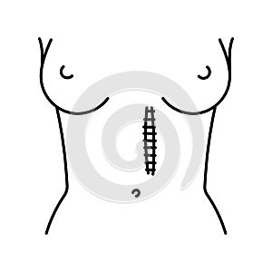 Paramedian incision line icon. Abdominal incisions.