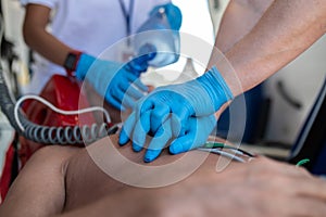 Paramedical staff performing the heart massage and oxygenation procedure