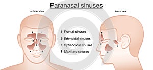 Paranasal Sinuses Anterior Lateral