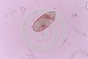 Parasite