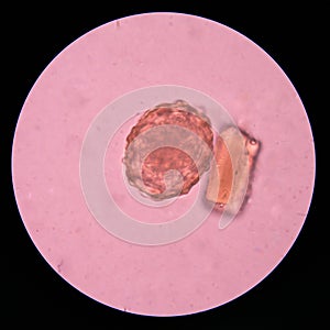 Parasite egg in stool exam.